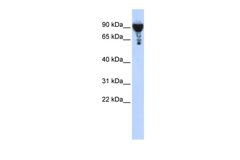 EXOC3 Rabbit Polyclonal Antibody
