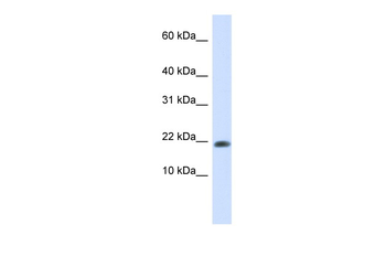 GABARAPL2 Rabbit Polyclonal Antibody