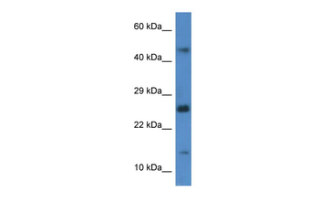 Gabarapl2 Rabbit Polyclonal Antibody