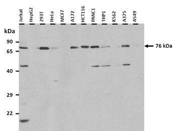 PADI2 Rabbit Polyclonal Antibody