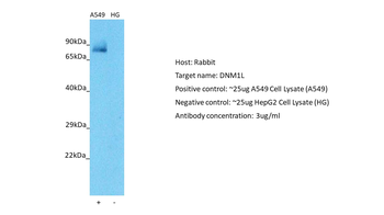 DNM1L Rabbit Polyclonal Antibody