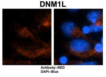 DNM1L Rabbit Polyclonal Antibody