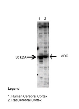 AZIN2 Rabbit Polyclonal Antibody