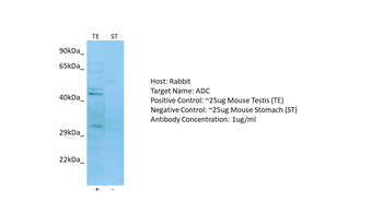 AZIN2 Rabbit Polyclonal Antibody