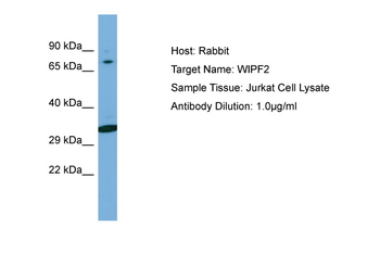 WIPF2 Rabbit Polyclonal Antibody