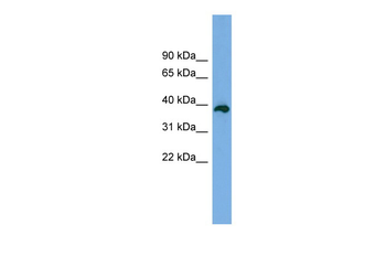 DEDD2 Rabbit Polyclonal Antibody