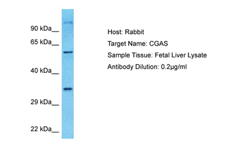 CGAS Rabbit Polyclonal Antibody