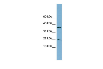 DUSP10 Rabbit Polyclonal Antibody