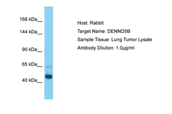 DENND5B Rabbit Polyclonal Antibody
