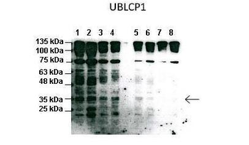 UBLCP1 Rabbit Polyclonal Antibody