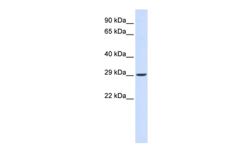 VTI1A Rabbit Polyclonal Antibody