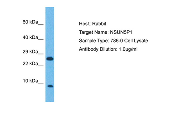 NSUN5P1 Rabbit Polyclonal Antibody