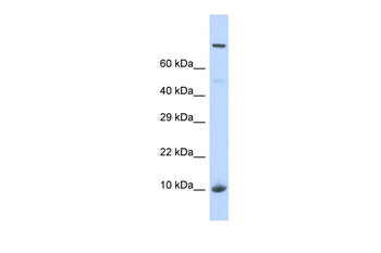 NSUN5P1 Rabbit Polyclonal Antibody