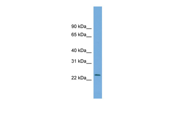 C5orf24 Rabbit Polyclonal Antibody