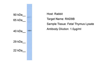 RAD9B Rabbit Polyclonal Antibody