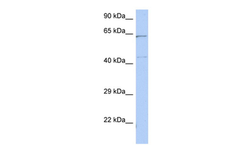 EME1 Rabbit Polyclonal Antibody
