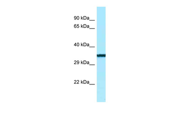 BTNL9 Rabbit Polyclonal Antibody