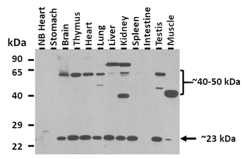 SGMS2 Rabbit Polyclonal Antibody