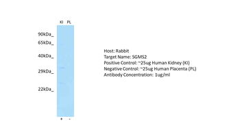 SGMS2 Rabbit Polyclonal Antibody
