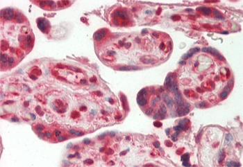 MLKL Rabbit Polyclonal Antibody