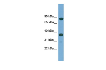 KHDRBS2 Rabbit Polyclonal Antibody