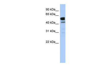 LDHD Rabbit Polyclonal Antibody