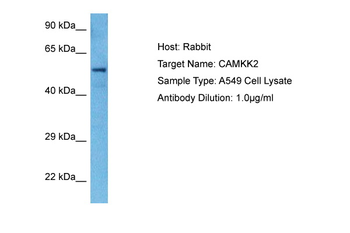 CAMKK2 Rabbit Polyclonal Antibody
