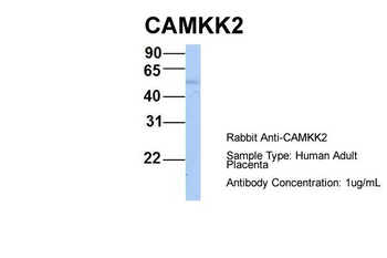 CAMKK2 Rabbit Polyclonal Antibody