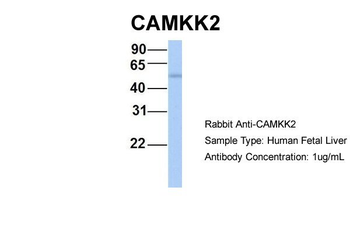 CAMKK2 Rabbit Polyclonal Antibody