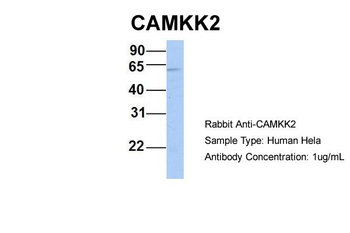 CAMKK2 Rabbit Polyclonal Antibody
