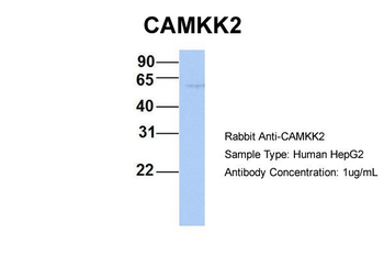 CAMKK2 Rabbit Polyclonal Antibody