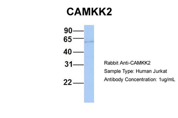 CAMKK2 Rabbit Polyclonal Antibody