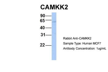 CAMKK2 Rabbit Polyclonal Antibody