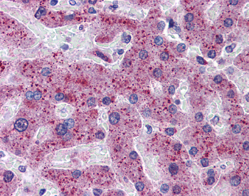 TMPRSS6 Rabbit Polyclonal Antibody