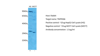TMPRSS6 Rabbit Polyclonal Antibody