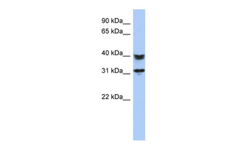 C5orf35 Rabbit Polyclonal Antibody