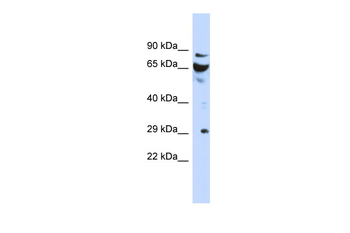 DCUN1D3 Rabbit Polyclonal Antibody