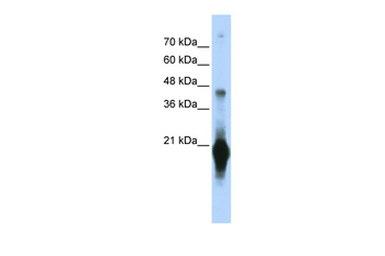 C17orf49 Rabbit Polyclonal Antibody