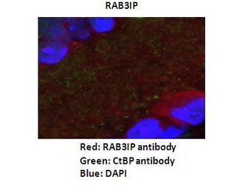 RAB3IP Rabbit Polyclonal Antibody