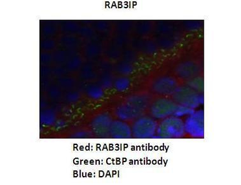 RAB3IP Rabbit Polyclonal Antibody