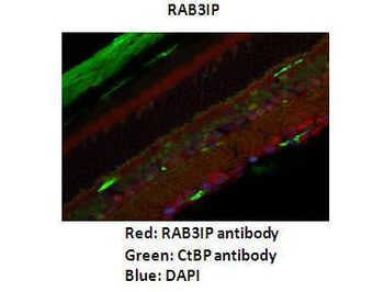 RAB3IP Rabbit Polyclonal Antibody