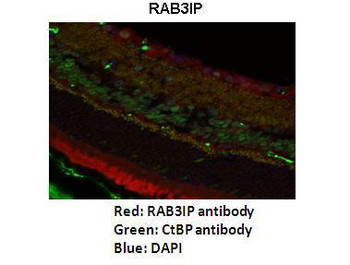 RAB3IP Rabbit Polyclonal Antibody