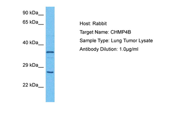 CHMP4B Rabbit Polyclonal Antibody