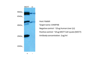 CHMP4B Rabbit Polyclonal Antibody