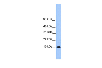 TRAPPC6B Rabbit Polyclonal Antibody