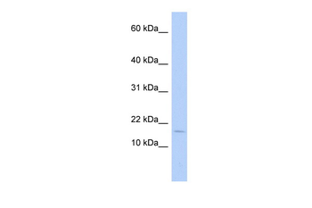 ISCA2 Rabbit Polyclonal Antibody