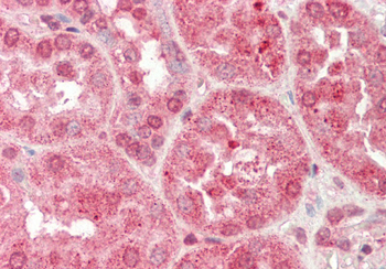 SERPINA5 Rabbit Polyclonal Antibody