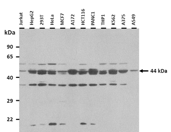IL13RA2 Rabbit Polyclonal Antibody