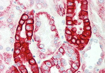 CRAT Rabbit Polyclonal Antibody