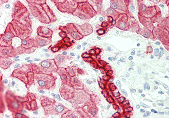 CRAT Rabbit Polyclonal Antibody